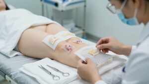 Biomaterials for chronic wound treatment: Types, benefits, and clinical considerations – English
