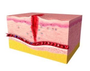 How ECM Supports Re-epithelialization