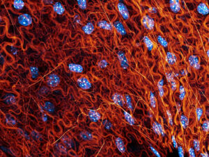 ECM and Cell Migration During Wound Repair